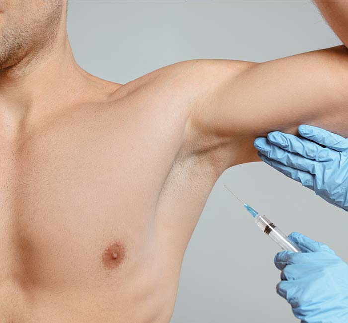 Hiperhidrosis